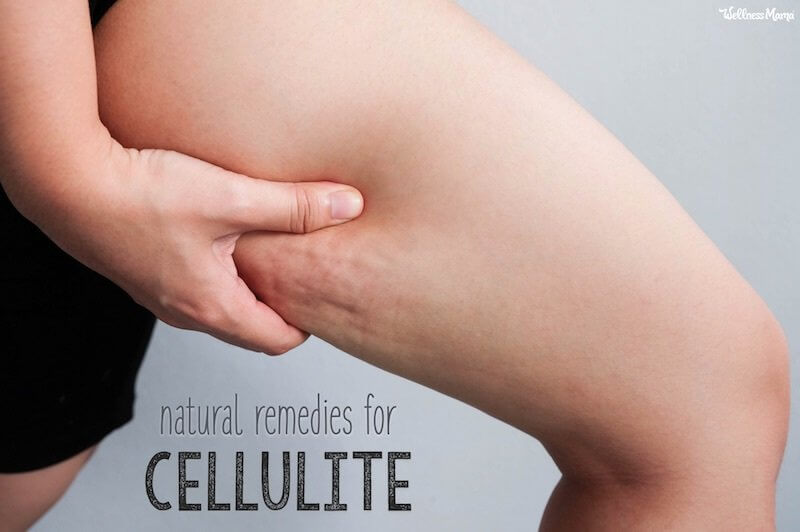 9 Natural Remedies for Cellulite