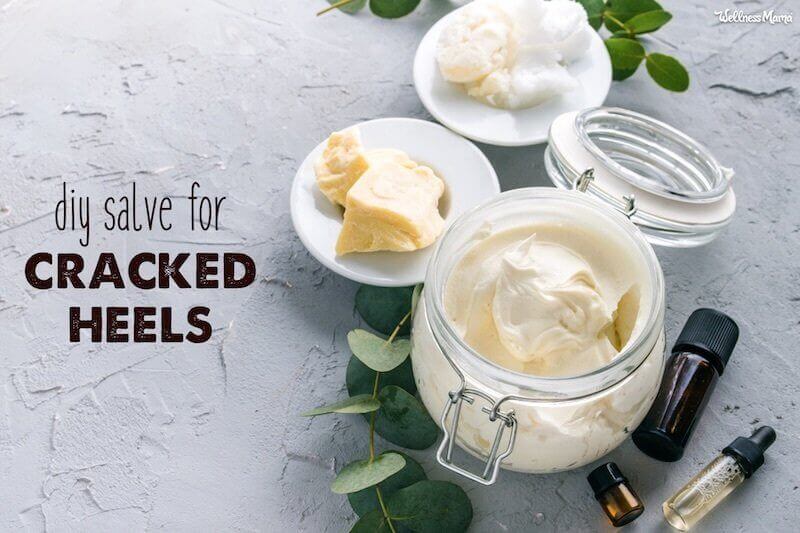 lotion for dry heels
