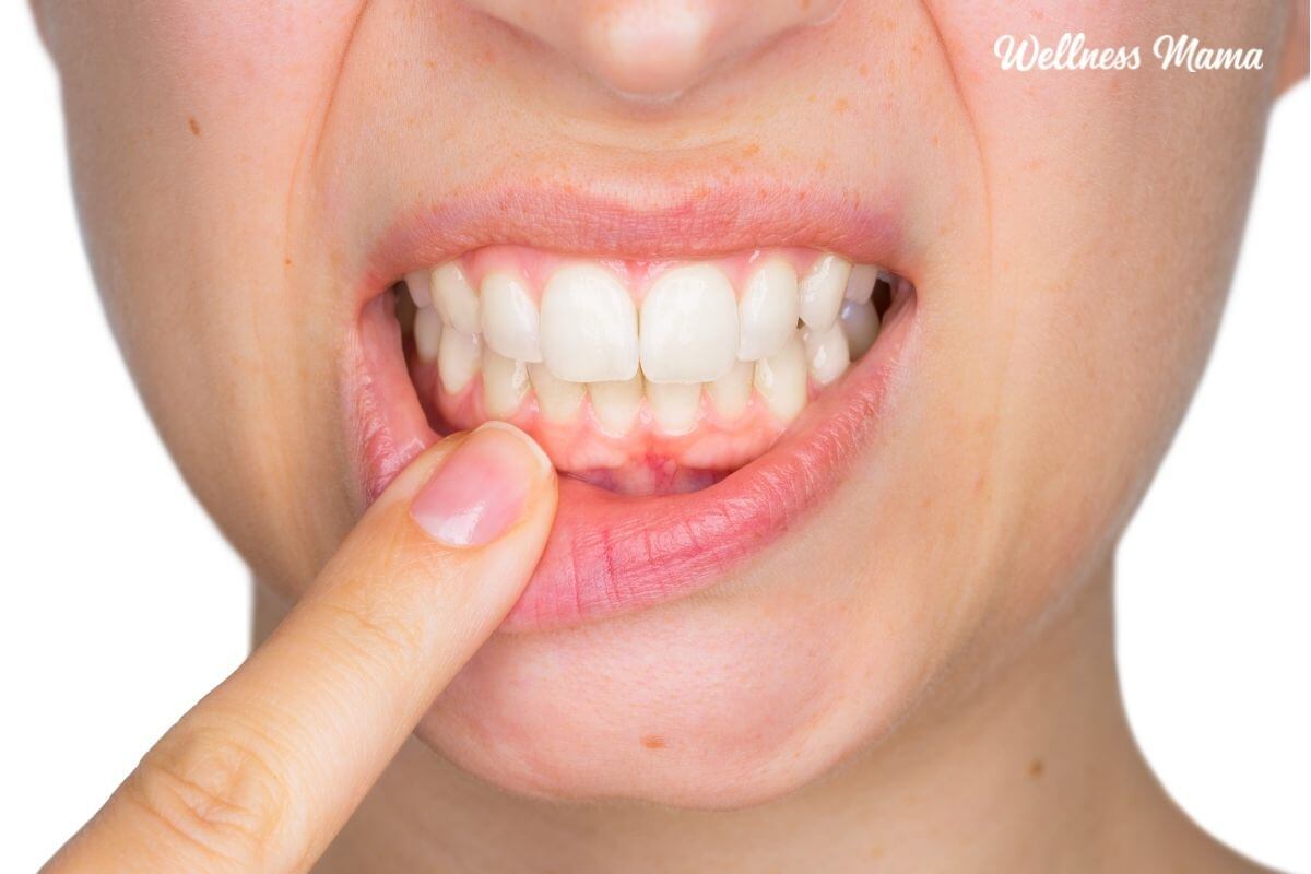 How gum disease affects the whole body