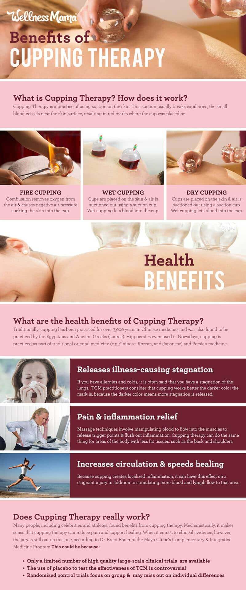 The-benefits-of-cupping-therapy-and-does-it-actually-work