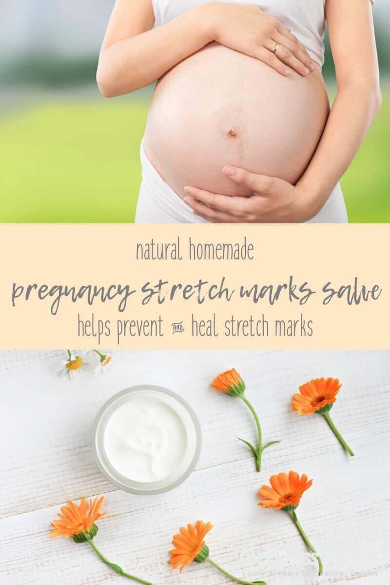 This natural salve uses shea butter and coconut oil with added herbs and carrier oils to create a soothing and moisturizing lotion to remove stretch marks.