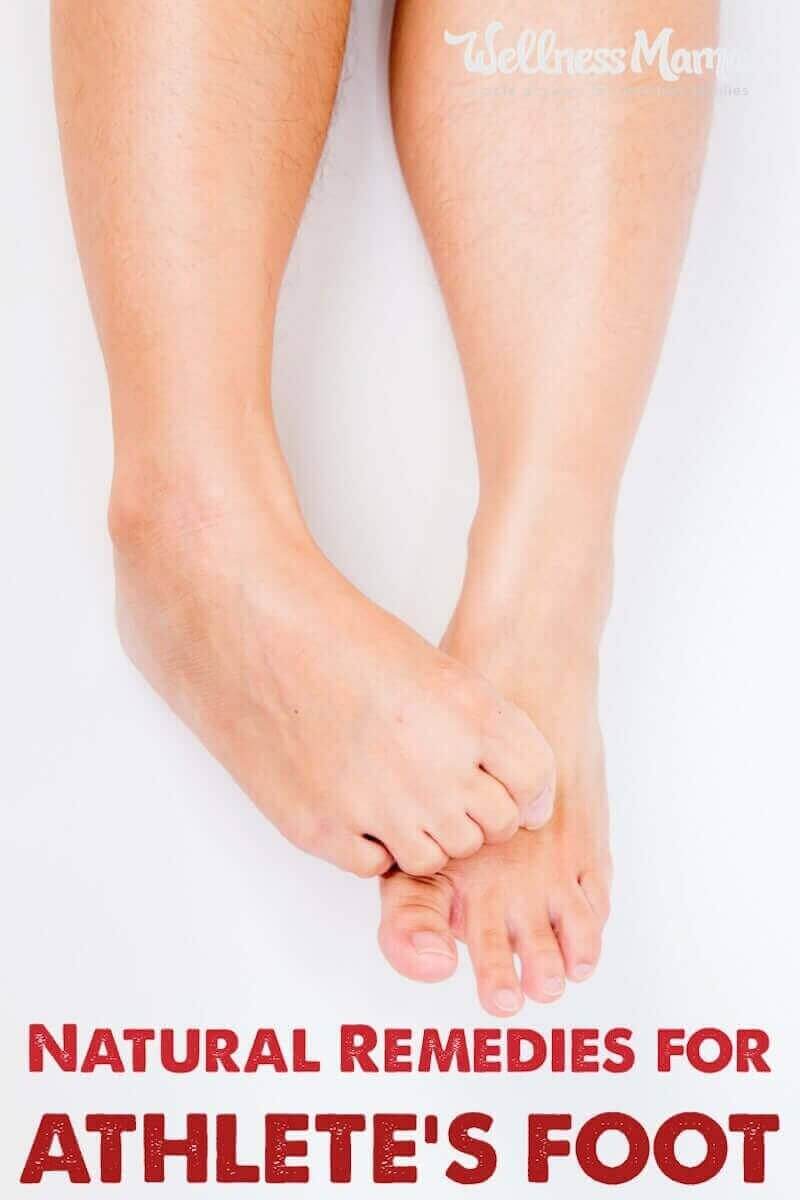 No one likes athlete's foot. Learn 5 effective natural remedies that are easy to make with ingredients you probably already have at home.